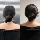 청담 승모근 보톡스 내돈내산 후기 용량 효과 관리