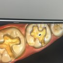 화이트디지털치과기공소 이미지