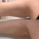 원한의원 | [내돈내산] 19만원? 한의원 다이어트 한달후기(-4kg)