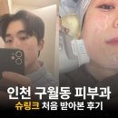 인천 구월동 피부과, 슈링크 300샷 내돈내산 (전후비교, 후기)