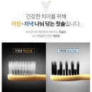 햇님 달님 | 햇님달님칫솔 사용 후 치아가 달라진 이유