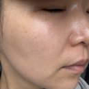 갈매중앙로 | 구리피부관리 올가드림뷰티 갈매중앙로점 비타민 미백관리 솔직후기