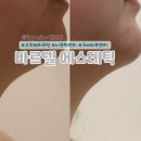 형곡로-5 | 구미 피부관리 추천ㅣ바르델에서 고주파리프팅으로 이중턱 관리 후기