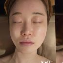 썸체형관리 이미지