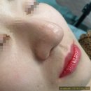 브로피시 네이버블로그