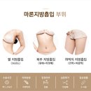 마론성형외과