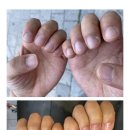 샾네일 이미지