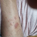 엠디메디칼(MD Medical) 네이버블로그