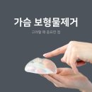 아미유외과의원 | 부산 가슴 보형물 제거 수술을 고려할 때 중요한 점