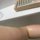 신영유치원 | 📍[인천/남동구] 셀포랩 온결점 후기 예비신부, 산후, 갱년기 여성 추천