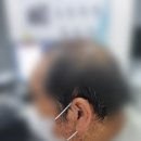 스타키보청기 네이버블로그