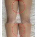 오뉴에스테틱 | [공덕 에스테틱] 더 오뉴 바디슬리밍 하체관리 후기, 웨딩케어로 딱 좋은 라인관리!