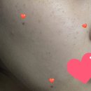 일산메이퓨어의원 네이버블로그