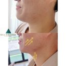 오라클 피부관리 이미지