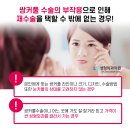 LK성형외과의원 네이버블로그
