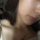 경주여드름관리 • 악건성 예민 좁쌀여드름 피부 구원 • 더뮤즈뷰티