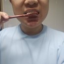 더블유디자인 | [잇몸치약] 닥터더블유 치약 일주일 써본 솔직한 후기