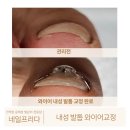 프리다네일