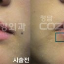 코지피어싱