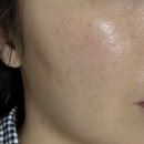 오름메디 | [메디큐엔 더마쿨RX 미스트] 안면홍조 민감한 얼굴