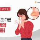 노란콧물원인 알아보고 그에 따른 법, 예방법을 알아봅시다! 이미지