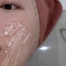 진아름다운피부과의원 | 청담동 피부과 에이든의원 티타늄리프팅 효과 얼굴리프팅 후기