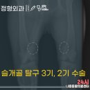 223-운정3-223 | 치와와 강아지 고양운정 슬개골전문 동물병원에서 슬개골 탈구 2기, 3기 수술 후기