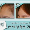 연세성형외과 이미지