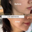 세븐일레븐 대구수성동아점 | 대구 수성구 피부관리 얼굴라인 고민이라면 스파더블유테라피