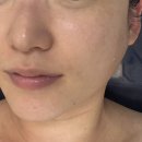 소사탕후루 | [미샵] 부천피부관리 추천 / 옥길동 하이푸리프팅