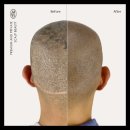 탈모왕 본점 이미지