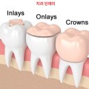 커스텀기공소 이미지