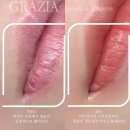 부산 연산동 입술 반영구 ‘그라치아’ 솔직 후기 – 시술부터 관리법까지