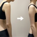자세교정 스트레칭(소도구 활용 운동) 이미지