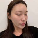 원주 피부관리 혁신도시 셀린에스테틱 상떼 아줄렌 LDM 관리 후기