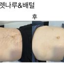 왁싱비왁싱B