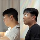 티프라임컨설팅 | 이중턱살 리프팅 튠페이스 내돈내산 가격 효과 후기