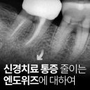 김해율하치과 신경치료 통증 줄이는 엔도위즈 후기