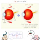 비전아이 이미지