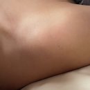 나래체형관리