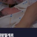 콩알II 네이버블로그