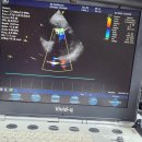 GE 3Sc-RS Sector Array Ultrasound Transducer Probe 이미지