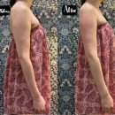 위드미 광주신안점 | [광주 수완지구 바디관리] 광주 웨딩관리, 팔뚝라인 관리 추천 후기 - 365메디스킨