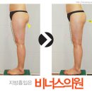 비너스의원 이미지