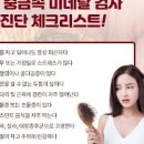 조울증 증상 조울증자가진단 체크리스트 이미지