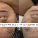 뷰티원 이미지