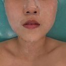 창원리프팅관리 온다웨이브 찐후기 고운빛깔에스테틱