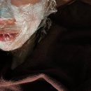 여의도 피부과 모공 관리 3주차 후기 (아토스레이저,에어서브시젼,모공주사)
