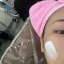 부천 여드름 문제성피부 여드름흉터 전문 써니뷰티부천상동점 에어플라즈마 여드름관리 받은 후기 주차가능