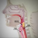 응급처치법- 기도가 막혔을때(하임리히법) 이미지